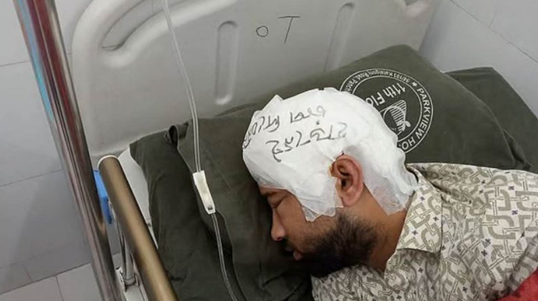 চবি শিক্ষার্থী মামুন মিয়া গুরুতর আহত, মাথার খুলি ফ্রিজে রাখা হয়েছে